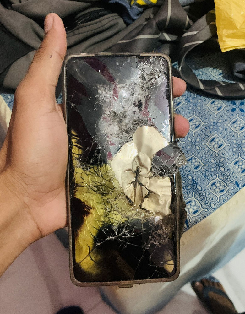 Новенький Redmi Note 12 Pro загорелся в нагрудном кармане пользователя